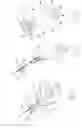 Fig. 29 - Pneumoperitoneum device