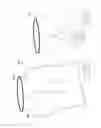 Fig. 52 - Pneumoperitoneum device