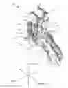 Fig. 01 - Spondylolisthesis reduction system