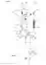 Fig. 08 - Spondylolisthesis reduction system