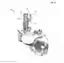 Fig. 11 - Spondylolisthesis reduction system