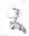 Fig. 12 - Spondylolisthesis reduction system