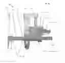 Fig. 14 - Spondylolisthesis reduction system
