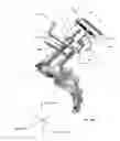 Fig. 19 - Spondylolisthesis reduction system