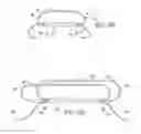 Fig. 05 - Fracture fixation device