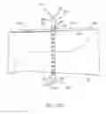 Fig. 10 - Fracture fixation device