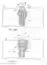 Fig. 11 - Fracture fixation device