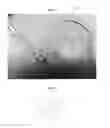 Fig. 02 - Systems and methods for preparing reinforced graft constructs