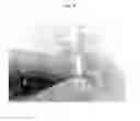 Fig. 05 - Systems and methods for preparing reinforced graft constructs