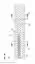 Fig. 58 - Round-flat-round surgical braids