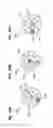 Fig. 63 - Round-flat-round surgical braids