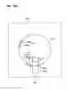 Fig. 92 - Round-flat-round surgical braids