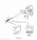 Fig. 13 - SURGICAL CUTTING INSTRUMENT THAT ANALYZES TISSUE THICKNESS