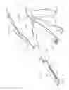 Fig. 02 - Surgical instrument including a shifting assembly