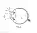 Fig. 09 - Fasteners, deployment systems, and methods for ophthalmic tissue closure and fixation of ophthalmic prostheses and other uses