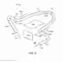 Fig. 10 - Fasteners, deployment systems, and methods for ophthalmic tissue closure and fixation of ophthalmic prostheses and other uses