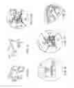 Fig. 13 - Fasteners, deployment systems, and methods for ophthalmic tissue closure and fixation of ophthalmic prostheses and other uses