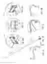 Fig. 15 - Fasteners, deployment systems, and methods for ophthalmic tissue closure and fixation of ophthalmic prostheses and other uses