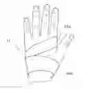 Fig. 01 - Method of transradial catheterization, device for ulnar artery compression, and method of use