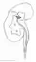 Fig. 01 - METHODS AND SYSTEMS FOR REMOVING TISSUE FROM BODY CAVITIES