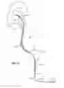 Fig. 04 - METHODS AND SYSTEMS FOR REMOVING TISSUE FROM BODY CAVITIES