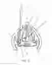 Fig. 15 - Devices and methods for anterior arytenoid adduction