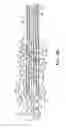 Fig. 07 - Wrist assembly for articulating laparoscopic surgical instruments