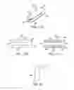 Fig. 16 - Wrist assembly for articulating laparoscopic surgical instruments