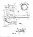 Fig. 02 - Apparatus And Methods For Treating Undesired Viens
