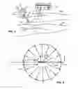 Fig. 03 - Apparatus And Methods For Treating Undesired Viens