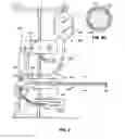 Fig. 07 - Apparatus And Methods For Treating Undesired Viens