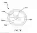 Fig. 04 - First-entry trocar system