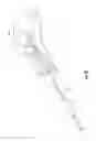 Fig. 09 - DEVICE FOR PLACEMENT OF AN INTRAUTERINE BALLOON