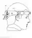 Fig. 01 - Method and device for positioning and stabilization of bony structures during maxillofacial surgery
