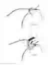 Fig. 09 - Method and device for positioning and stabilization of bony structures during maxillofacial surgery