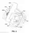 Fig. 04 - METHODS AND DEVICES FOR ANCHORING SPINAL RODS