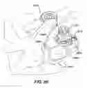 Fig. 86 - METHODS AND DEVICES FOR ANCHORING SPINAL RODS