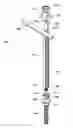 Fig. 01 - Spine alignment system