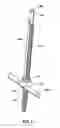 Fig. 06 - Spine alignment system