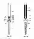 Fig. 12 - Spine alignment system