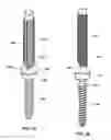 Fig. 13 - Spine alignment system