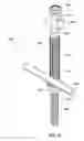 Fig. 14 - Spine alignment system