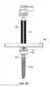 Fig. 15 - Spine alignment system