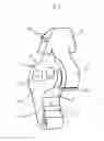 Fig. 02 - Interspinous process spacer implant