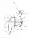 Fig. 03 - Interspinous process spacer implant