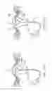 Fig. 17 - Cryogenic treatment systems