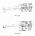 Fig. 55 - Cryogenic treatment systems