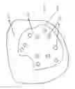 Fig. 13 - System, method and computer-accessible medium for in-vivo tissue ablation and/or damage