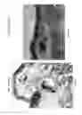 Fig. 34 - System, method and computer-accessible medium for in-vivo tissue ablation and/or damage