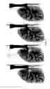 Fig. 35 - System, method and computer-accessible medium for in-vivo tissue ablation and/or damage